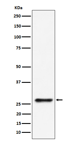 1 - Anti-SBDS Rabbit Monoclonal Antibody ABO16118