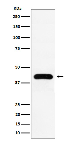 1 - Anti-MVD Rabbit Monoclonal Antibody ABO16121