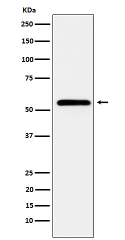1 - Anti-CaMKII Rabbit Monoclonal Antibody ABO16125