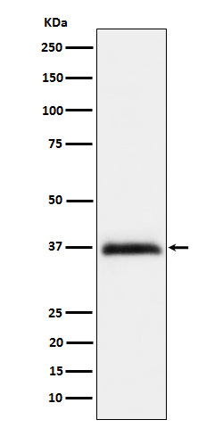 1 - Anti-RGMA Rabbit Monoclonal Antibody ABO16133
