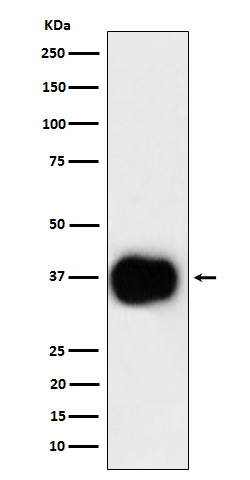 1 - Anti-CD79b Rabbit Monoclonal Antibody ABO16135