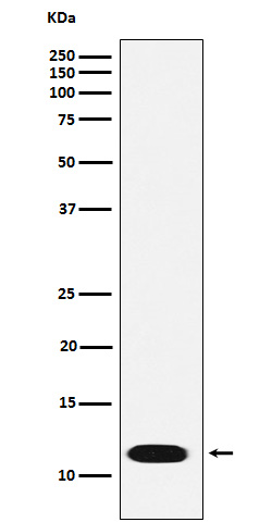 1 - Anti-CTNNBIP1 Rabbit Monoclonal Antibody ABO16138