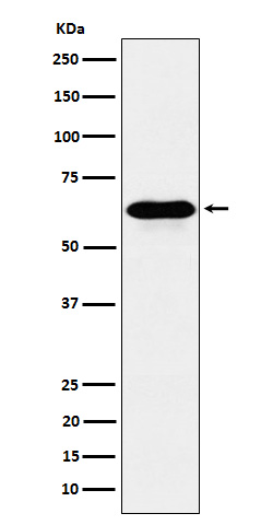 1 - Anti-COASY Rabbit Monoclonal Antibody ABO16139