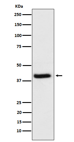 1 - Anti-HFE Rabbit Monoclonal Antibody ABO16141
