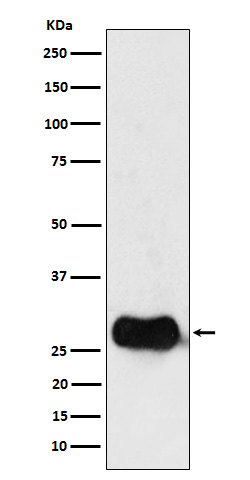 1 - Anti-HLA DMB Rabbit Monoclonal Antibody ABO16142