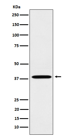 1 - Anti-LTB4R Rabbit Monoclonal Antibody ABO16144