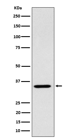 1 - Anti-ARPC2 Rabbit Monoclonal Antibody ABO16145