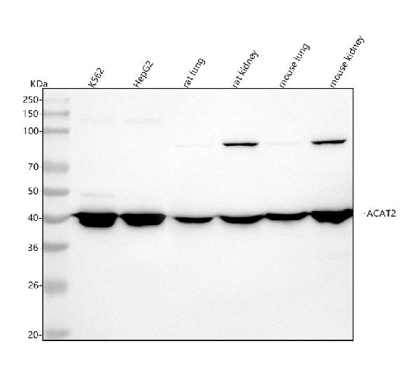 1 - Anti-ACAT2 Rabbit Monoclonal Antibody ABO16147