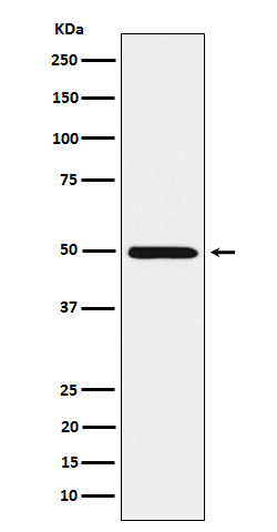 1 - Anti-HGD Rabbit Monoclonal Antibody ABO16148