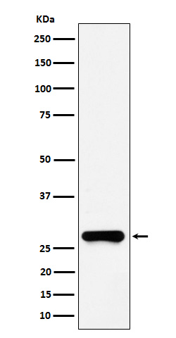 1 - Anti-GSTO1 Rabbit Monoclonal Antibody ABO16151