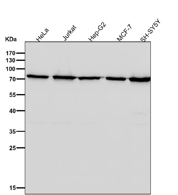 1 - Anti-CPSF73 Rabbit Monoclonal Antibody ABO16155