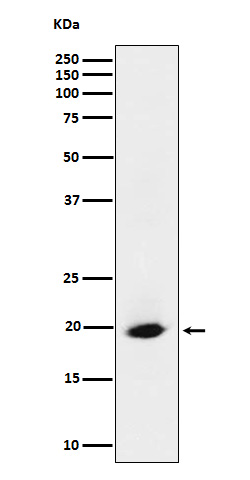 1 - Anti-SRP19 Rabbit Monoclonal Antibody ABO16157