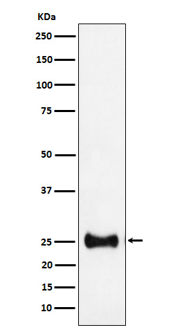 1 - Anti-Adenylate kinase 4 Rabbit Monoclonal Antibody ABO16160