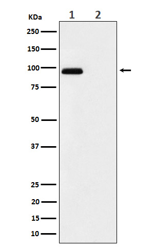 1 - Anti-Phospho-FGFR3 (Y724) Rabbit Monoclonal Antibody ABO16161