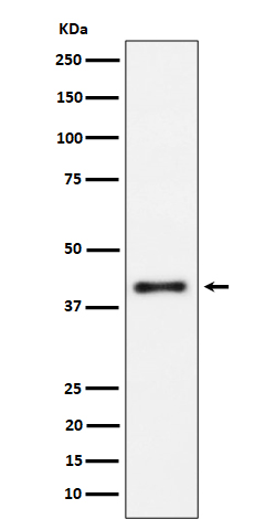 1 - Anti-IL15RA Rabbit Monoclonal Antibody ABO16162