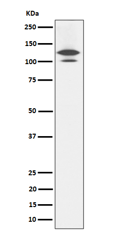1 - Anti-RASA1 Rabbit Monoclonal Antibody ABO16163