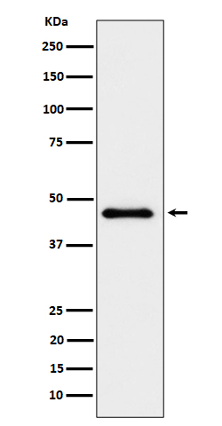 1 - Anti-ELP4 Rabbit Monoclonal Antibody ABO16169