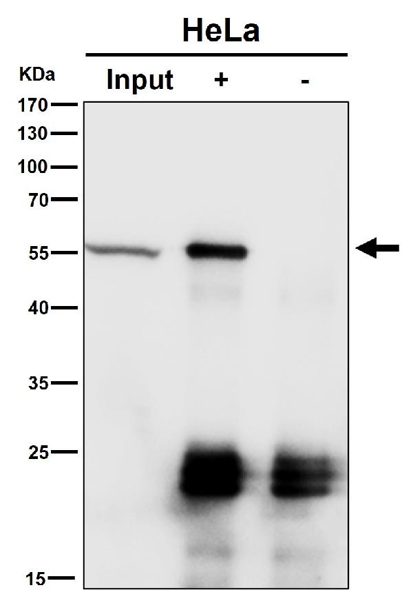 1 - Anti-CAP1 Rabbit Monoclonal Antibody ABO16171
