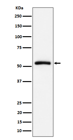 1 - Anti-CAP1 Rabbit Monoclonal Antibody ABO16171