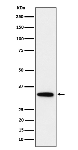 1 - Anti-PPP6C Rabbit Monoclonal Antibody ABO16174