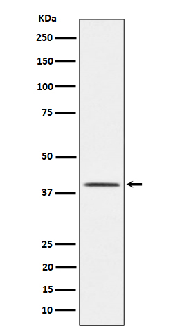 1 - Anti-TTF1 Rabbit Monoclonal Antibody ABO16179