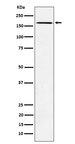 1 - Anti-AGL Rabbit Monoclonal Antibody ABO16180