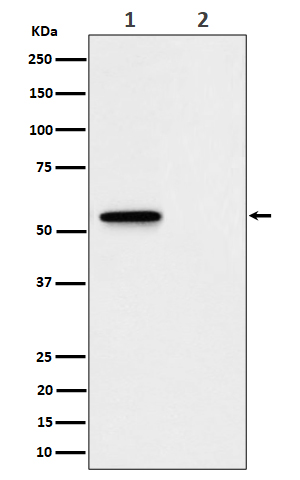 1 - Anti-Phospho-MLKL (S345) Rabbit Monoclonal Antibody ABO16185