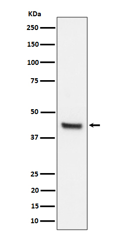 1 - Anti-IL11RA Rabbit Monoclonal Antibody ABO16186