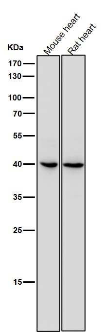 1 - Anti-IL11RA Rabbit Monoclonal Antibody ABO16186