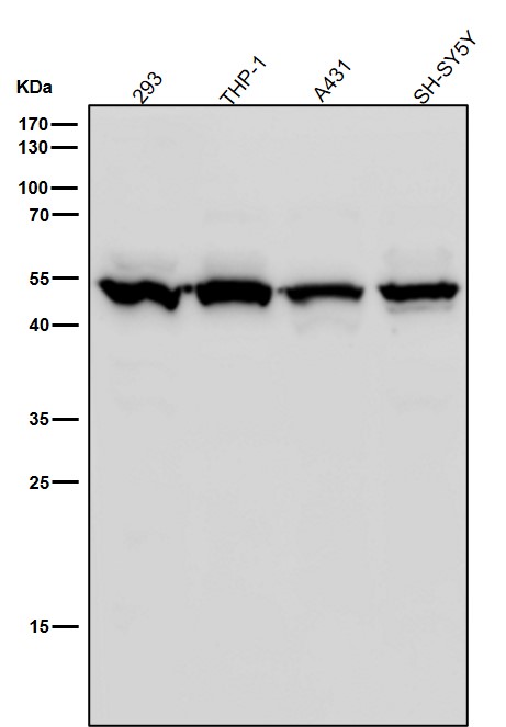 1 - Anti-IL11RA Rabbit Monoclonal Antibody ABO16186