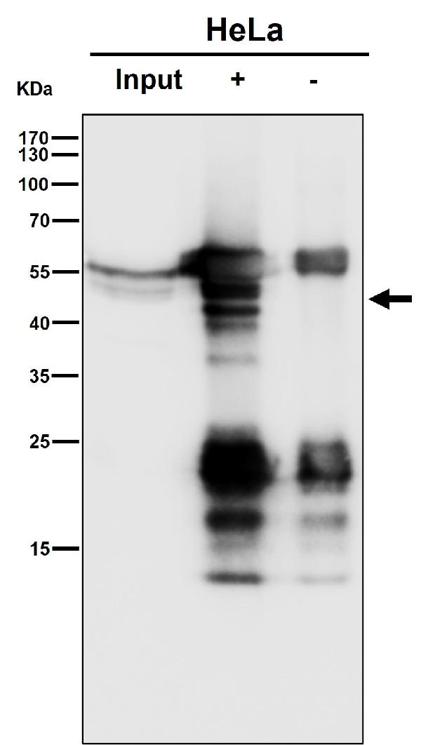 1 - Anti-PTPN2 Rabbit Monoclonal Antibody ABO16187