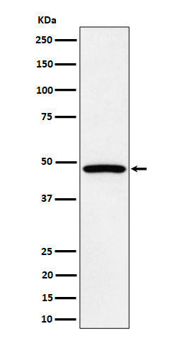 1 - Anti-PTPN2 Rabbit Monoclonal Antibody ABO16187