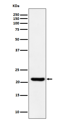 1 - Anti-ITPA Rabbit Monoclonal Antibody ABO16188