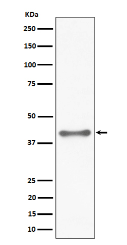 1 - Anti-TTF1 Rabbit Monoclonal Antibody ABO16189
