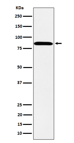 1 - Anti-PPM1E Rabbit Monoclonal Antibody ABO16190