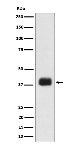 1 - Anti-SR protein repeat Rabbit Monoclonal Antibody ABO16191