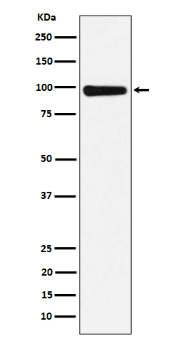 1 - Anti-CHM Rabbit Monoclonal Antibody ABO16192