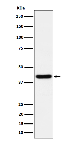 1 - Anti-Spermine synthase Rabbit Monoclonal Antibody ABO16193