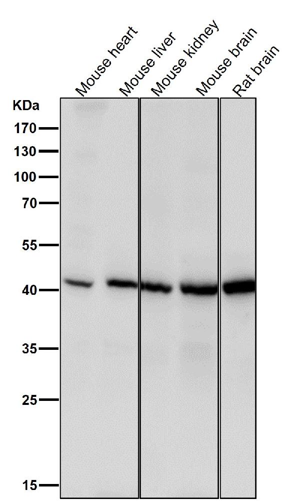 1 - Anti-Spermine synthase Rabbit Monoclonal Antibody ABO16193