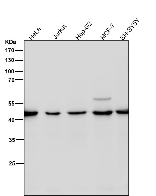 1 - Anti-Spermine synthase Rabbit Monoclonal Antibody ABO16193
