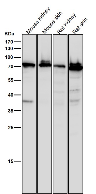 1 - Anti-SCIN Rabbit Monoclonal Antibody ABO16194