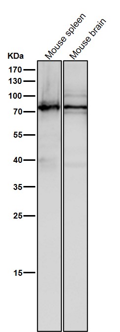 1 - Anti-SCIN Rabbit Monoclonal Antibody ABO16194
