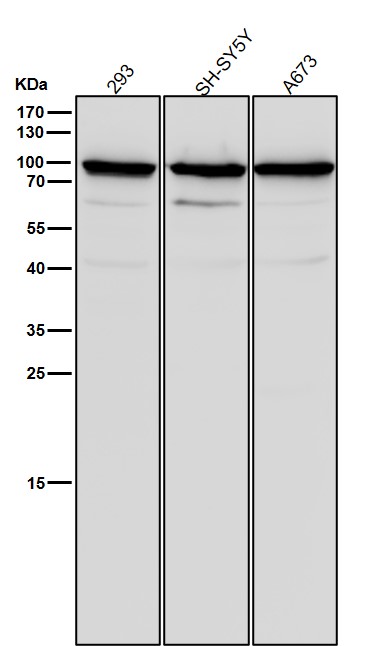 1 - Anti-SCIN Rabbit Monoclonal Antibody ABO16194