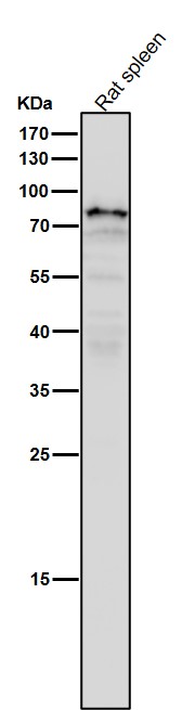 1 - Anti-SCIN Rabbit Monoclonal Antibody ABO16194