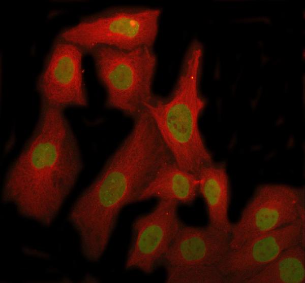 3 - Anti-TAF15 Rabbit Monoclonal Antibody ABO16196