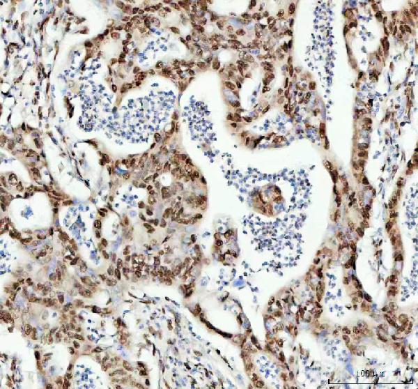 2 - Anti-TAF15 Rabbit Monoclonal Antibody ABO16196
