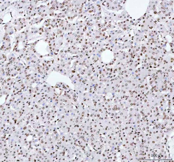 2 - Anti-TAF15 Rabbit Monoclonal Antibody ABO16196