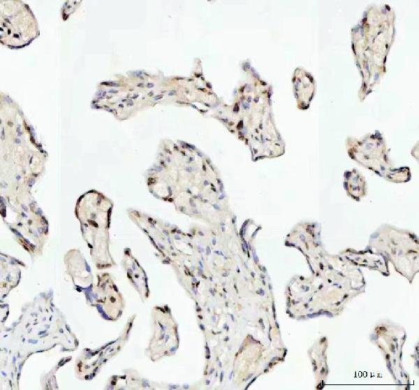 2 - Anti-TAF15 Rabbit Monoclonal Antibody ABO16196