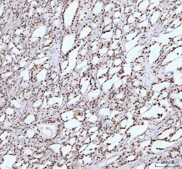 2 - Anti-TAF15 Rabbit Monoclonal Antibody ABO16196