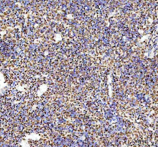 2 - Anti-TAF15 Rabbit Monoclonal Antibody ABO16196